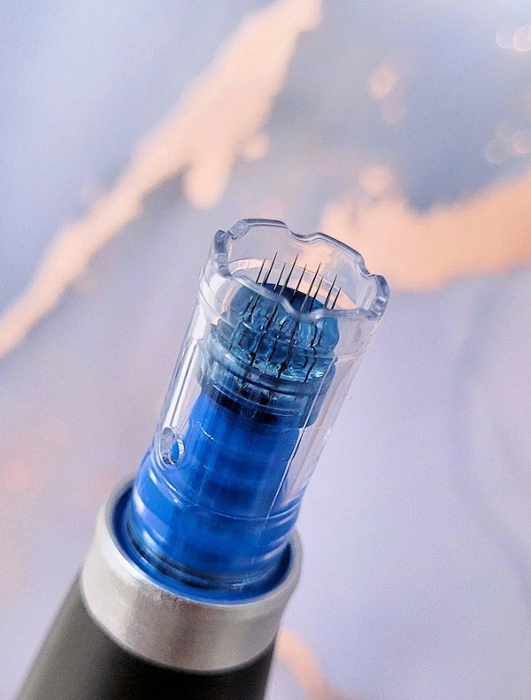 MICRONEEDLING